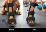 Walkin’® Splints Custom-fit Foam